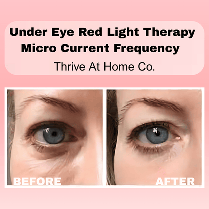Thrive - Under Eye Red Light Therapy - Thrive At Home Co.