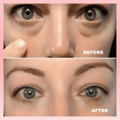 Thrive - Under Eye Red Light Therapy - Thrive At Home Co.