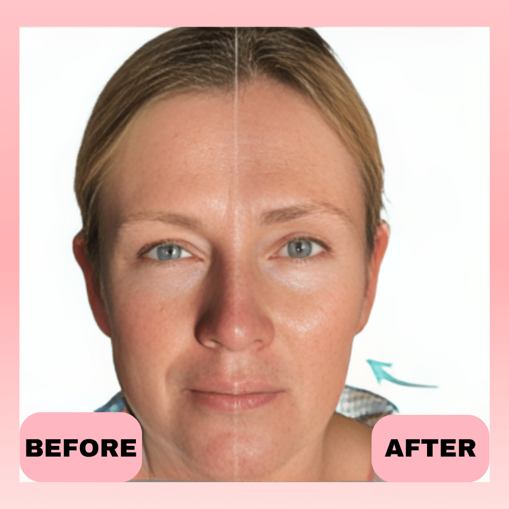 Thrive - Face Sculpting Pro - LED Tightening and Lifting Device - Thrive At Home Co.