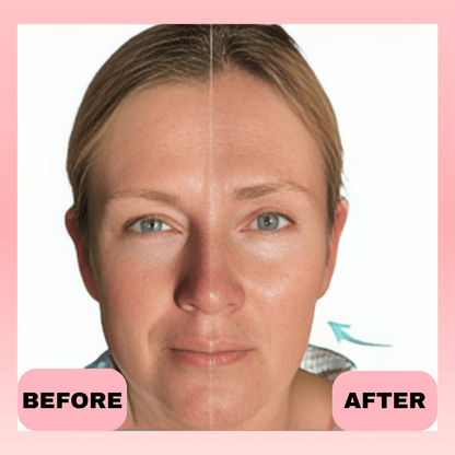 Thrive - Face Sculpting Pro - LED Tightening and Lifting Device - Thrive At Home Co.