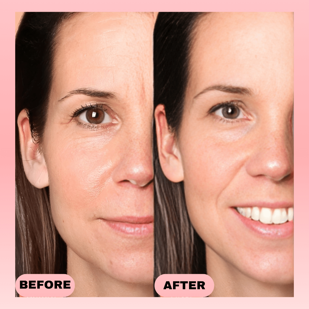 Thrive - Light Therapy Device - Thrive At Home Co.