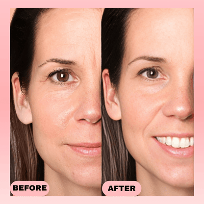 Thrive - Light Therapy Device - Thrive At Home Co.